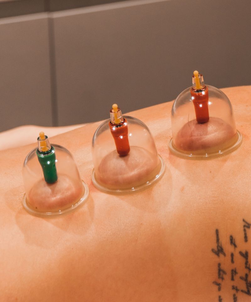 Cupping & Guasha with Honey Extraction | 60 Mins