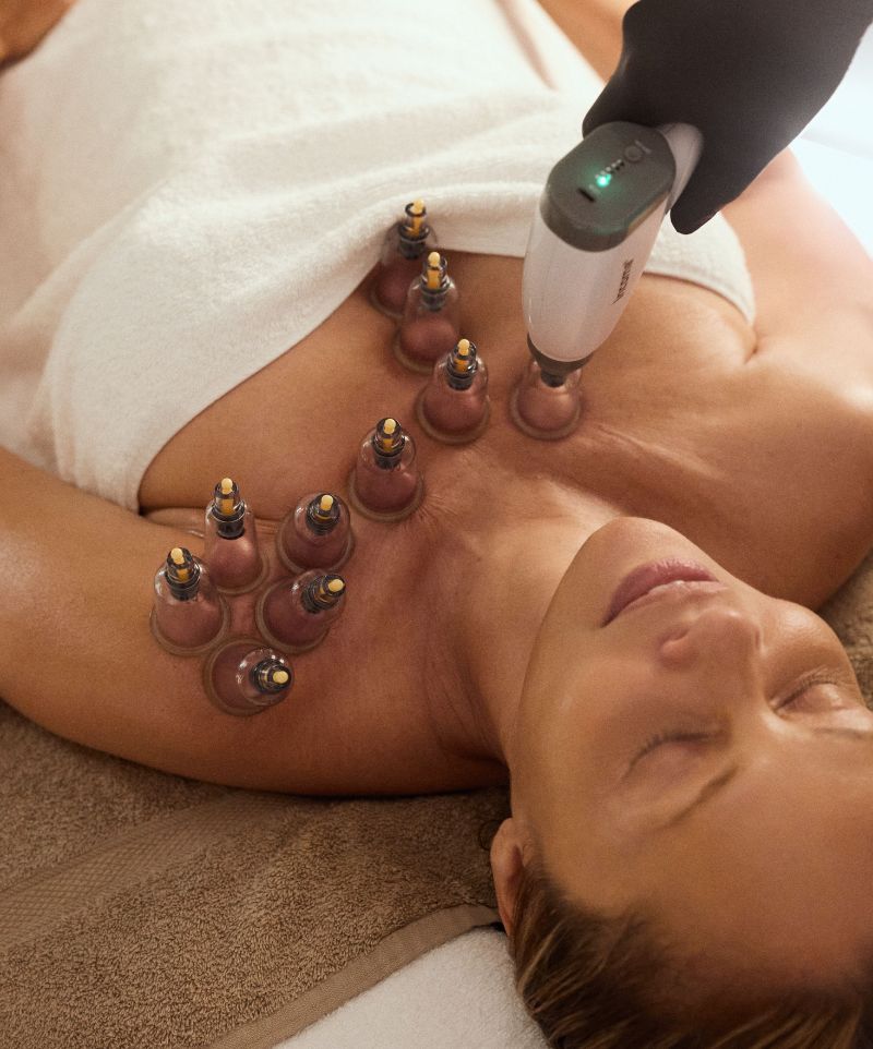 Cupping & Guasha with Honey Extraction | 60 Mins